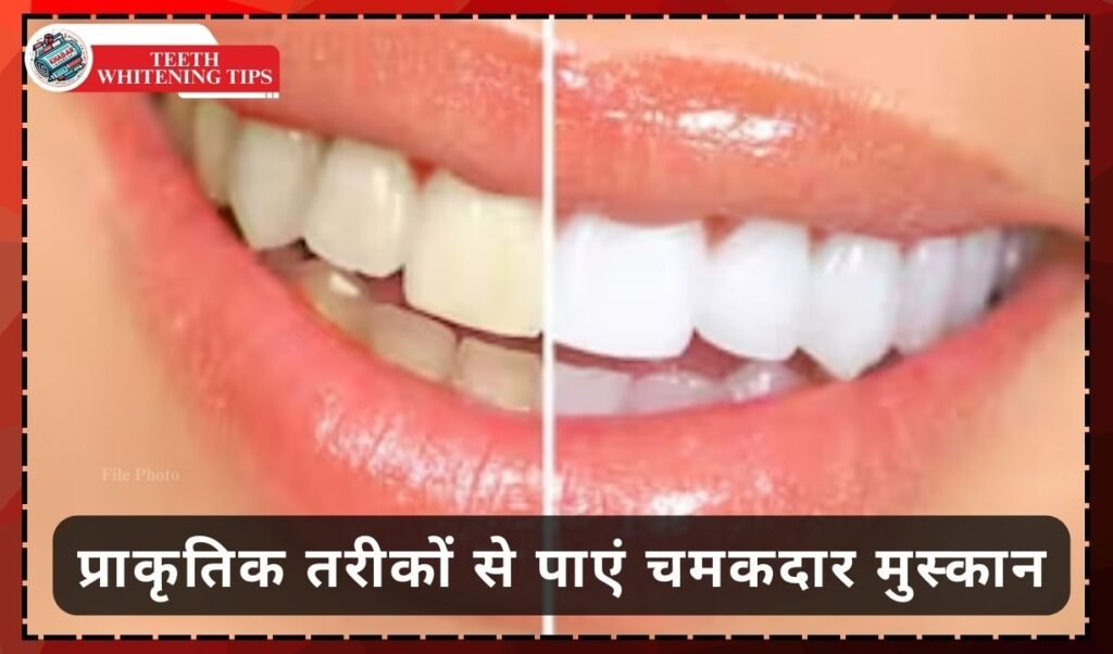 Teeth Whitening Tips: Easy home remedies to whiten yellow teeth – get pearly shine